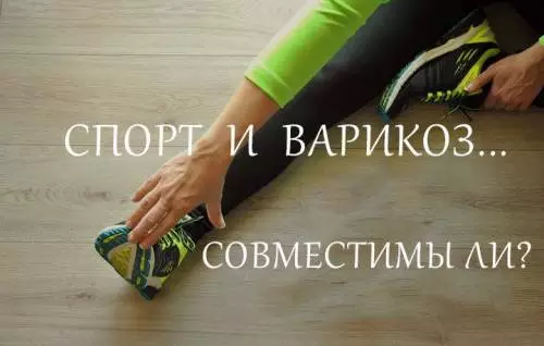 Чи можна займатися спортом при варикозі?