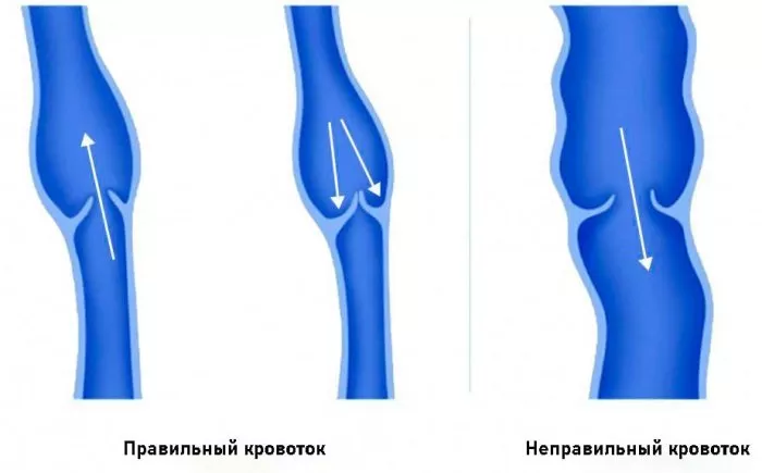 кровотік вен нижніх кінцівок
