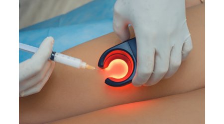 Безслідне усунення здутих вен – і це лише одна з переваг Foam-Form склеротерапії