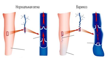 Як працюють вени