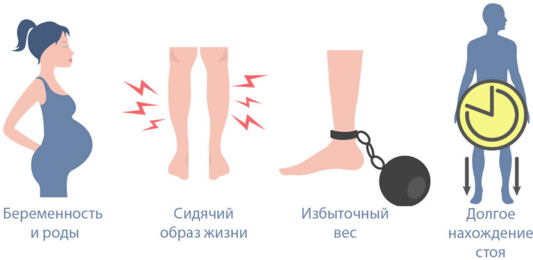 Каким должен быть образ жизни при варикозной болезни