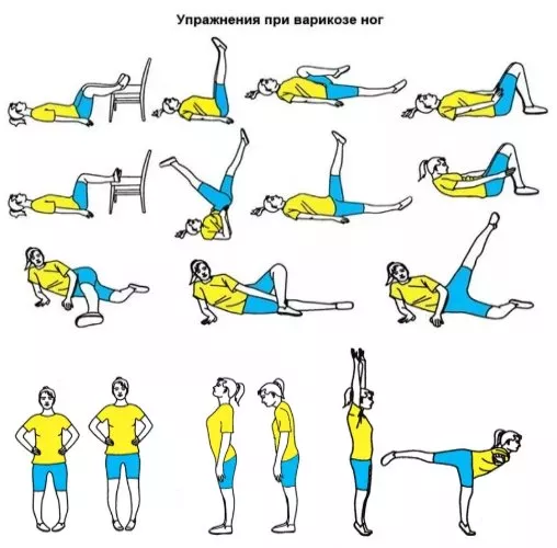 Вправи при варикозі ніг