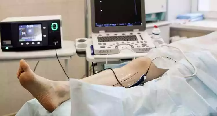 видалення вен на ногах хірургічним шляхом