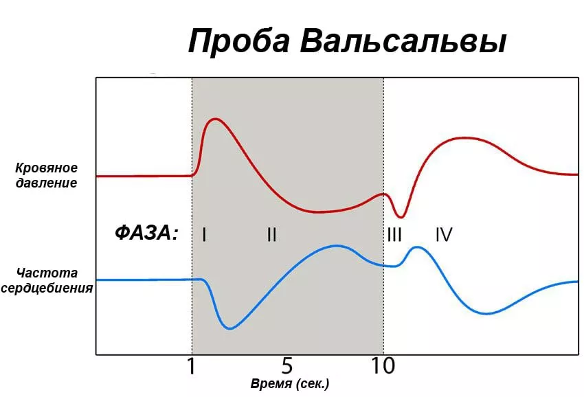 проба вальсальвы при варикозе