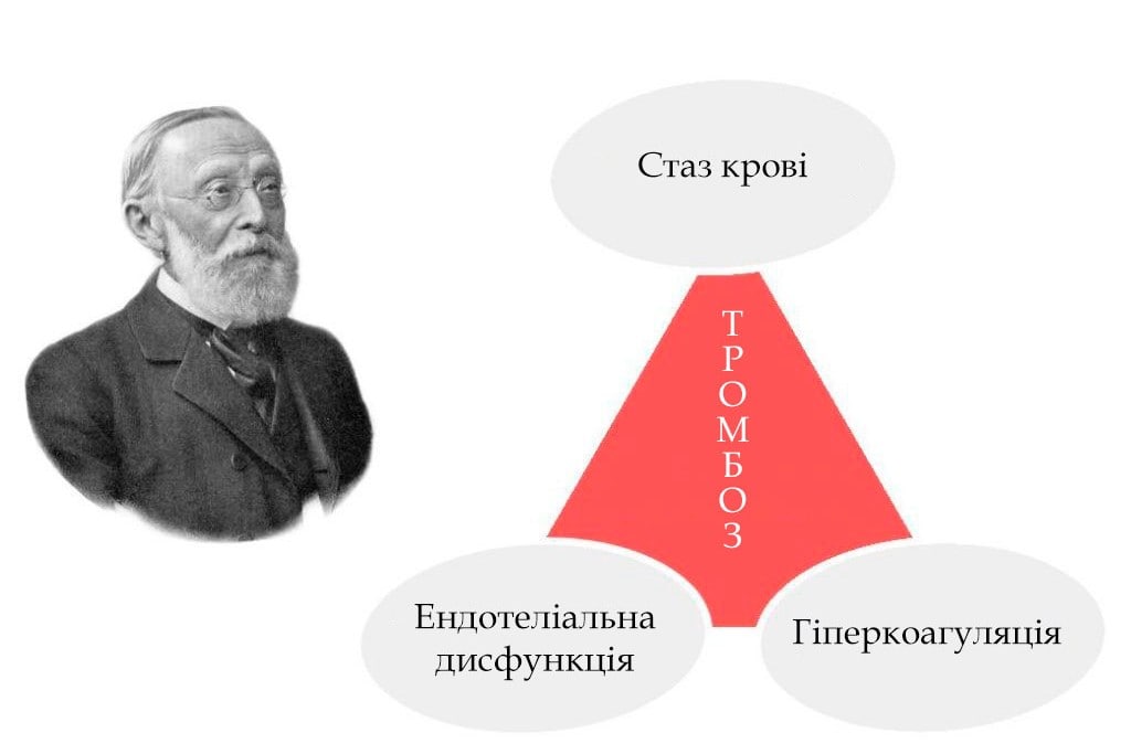 Фактори тромбоутворення (Тріада Вірхова)